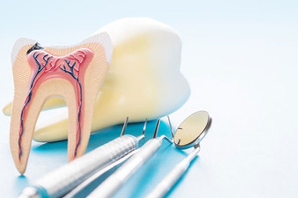 Seattle SmileWorks Seattle Family Dentist Root Canal Procedures